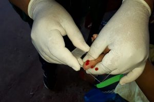 Semsa Manaus Orientações Malária 6 (3)